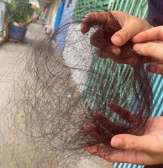 Ám ảnh rùng mình di chứng rụng tóc của người từng mắc Covid-19-1