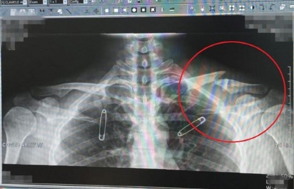 Yoo Ah In ngựa điên bất kham của Kbiz: tài năng đi kèm tai tiếng-6