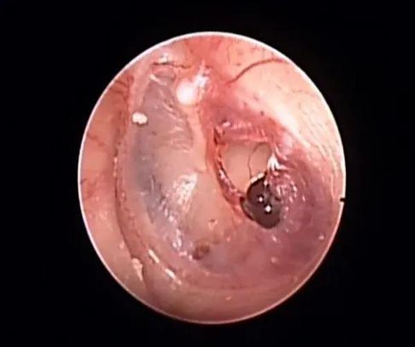 Hôn quá cuồng nhiệt, chàng trai khiến cô gái thủng màng nhĩ-2