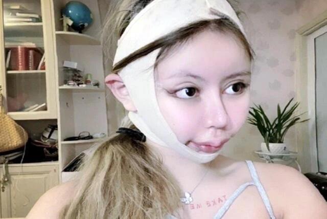 Nữ sinh chi 10,6 tỷ dao kéo, gương mặt sau 3 năm ai cũng sốc-4