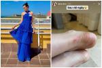 Đỗ Thị Hà 'bỏ xó' giày cao gót sau chấn thương xót xa ở Miss World