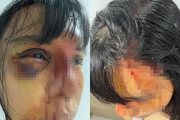 Siêu mẫu Khả Trang mất tích, bị đánh đập hung tàn là ai?-12