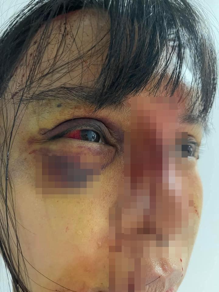 SỐC: Siêu mẫu Khả Trang bị bạo hành thân tàn ma dại-4