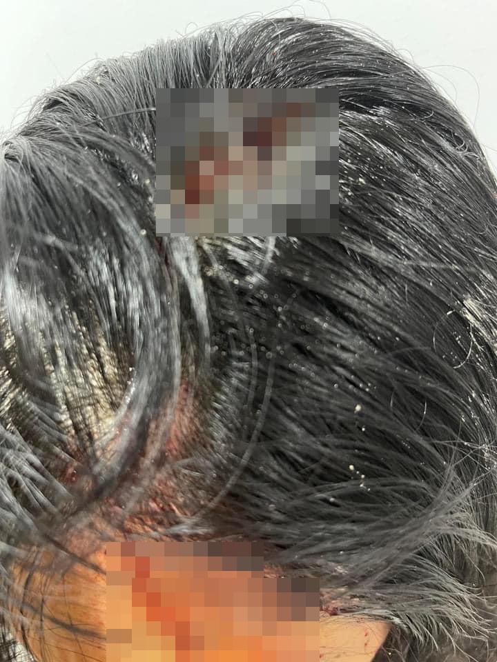 SỐC: Siêu mẫu Khả Trang bị bạo hành thân tàn ma dại-5