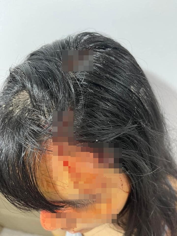 SỐC: Siêu mẫu Khả Trang bị bạo hành thân tàn ma dại-6