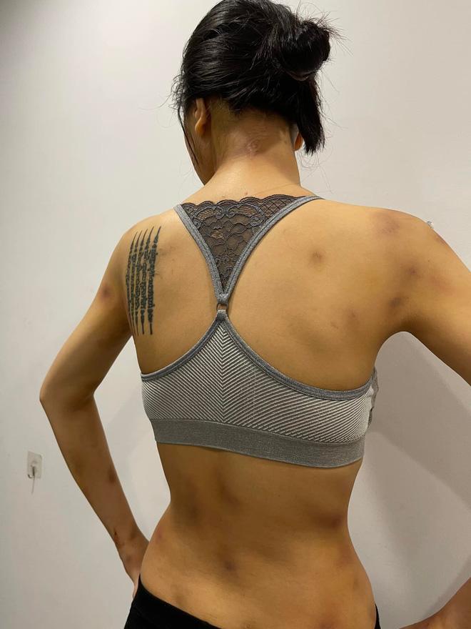 SỐC: Siêu mẫu Khả Trang bị bạo hành thân tàn ma dại-10