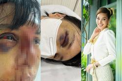 Siêu mẫu Khả Trang mất tích, bị đánh đập hung tàn là ai?