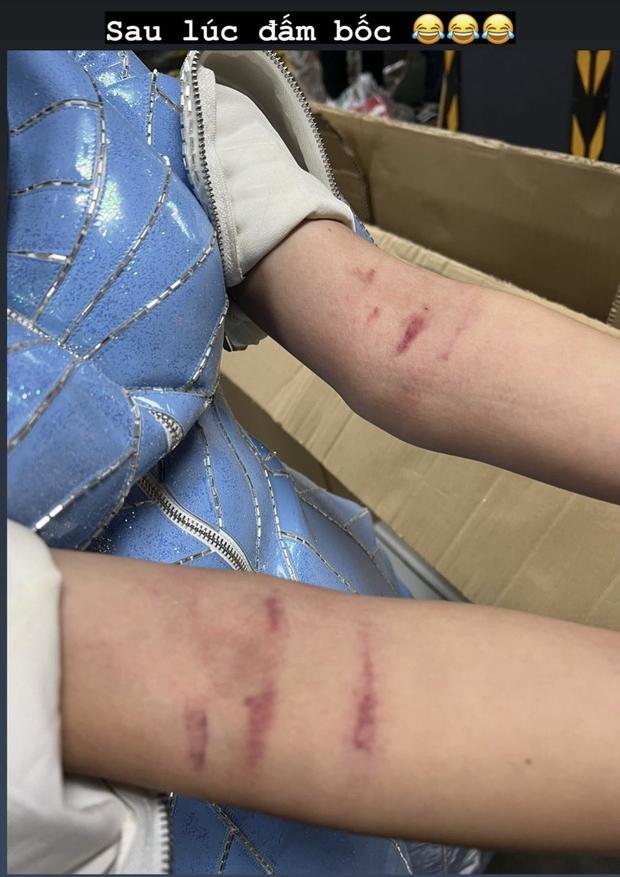 Các người đẹp thâm tím, chảy máu vì trang phục dân tộc khi đi thi quốc tế-4