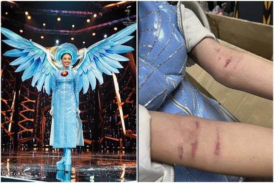 Các người đẹp thâm tím, chảy máu vì trang phục dân tộc khi đi thi quốc tế