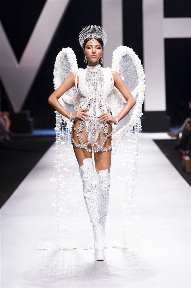 Khả Trang sau loạt bạo hành: Mặt vẫn sưng, mắt tụ máu-7