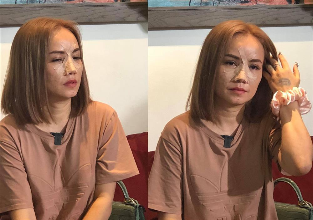 Loạt sao Việt hồng nhan bạc phận bị chồng bạo hành không nhận ra-3