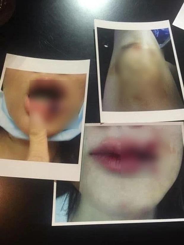Loạt sao Việt hồng nhan bạc phận bị chồng bạo hành không nhận ra-11
