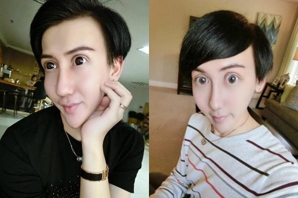 Ngỡ ngàng ngoại hình hot boy mặt rắn sau 7 năm dao kéo-3