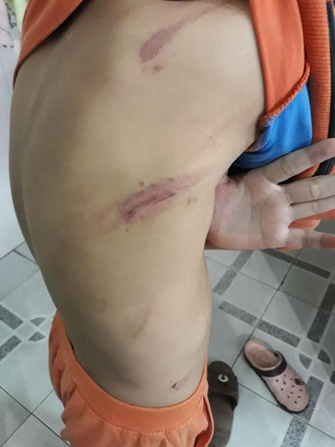 Học chậm tiến, bé trai 7 tuổi bị bố đánh dã man-2