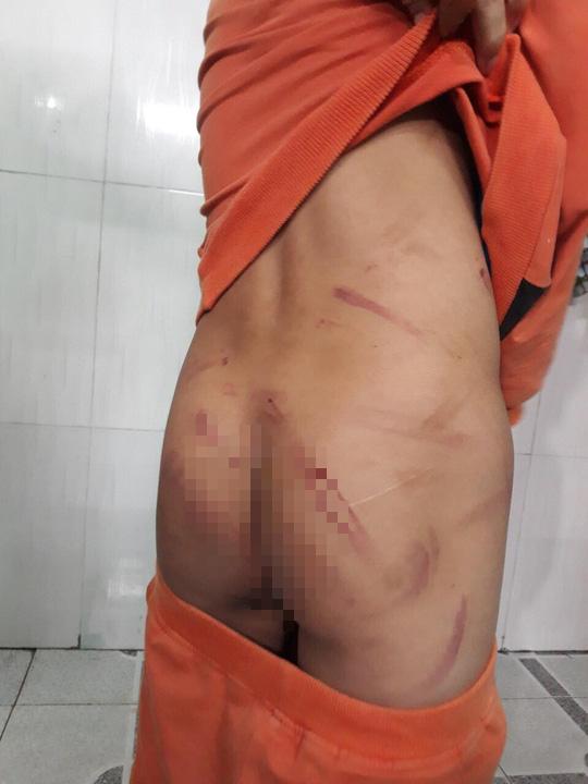 Học chậm tiến, bé trai 7 tuổi bị bố đánh dã man-3