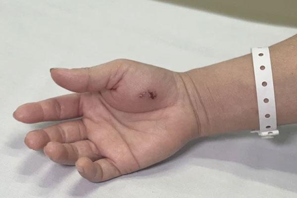 Hà Nội: Người đầu tiên bị con cu li cắn, vài phút sau giọng nói yếu hẳn-1