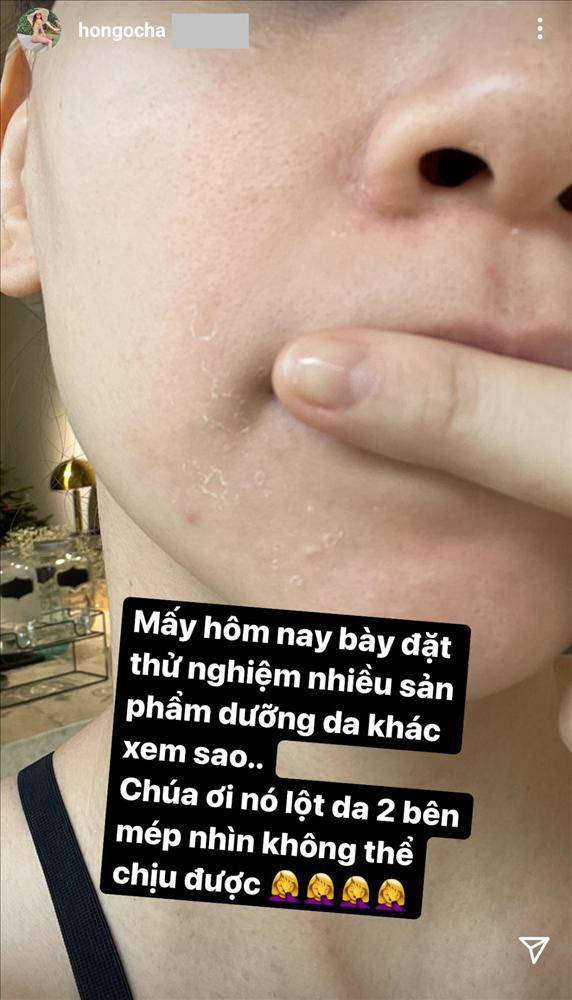Đến Hà Hồ cũng có ngày toang nặng làn da vì skincare vô tội vạ-3