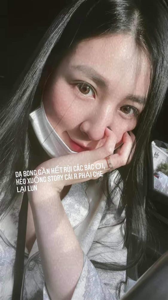 Đến Hà Hồ cũng có ngày toang nặng làn da vì skincare vô tội vạ-6