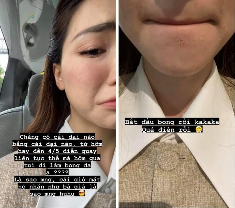 Đến Hà Hồ cũng có ngày toang nặng làn da vì skincare vô tội vạ-7