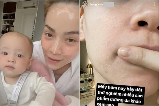 Đến Hà Hồ cũng có ngày 'toang nặng' làn da vì skincare vô tội vạ