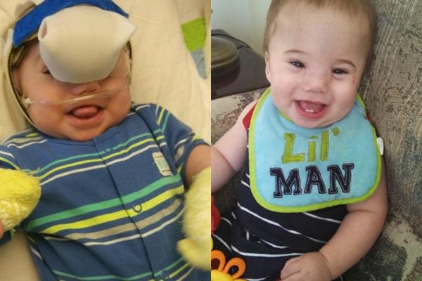 Cụ bà mang khối u vùng bụng tương đương thai nhi 9 tháng-3