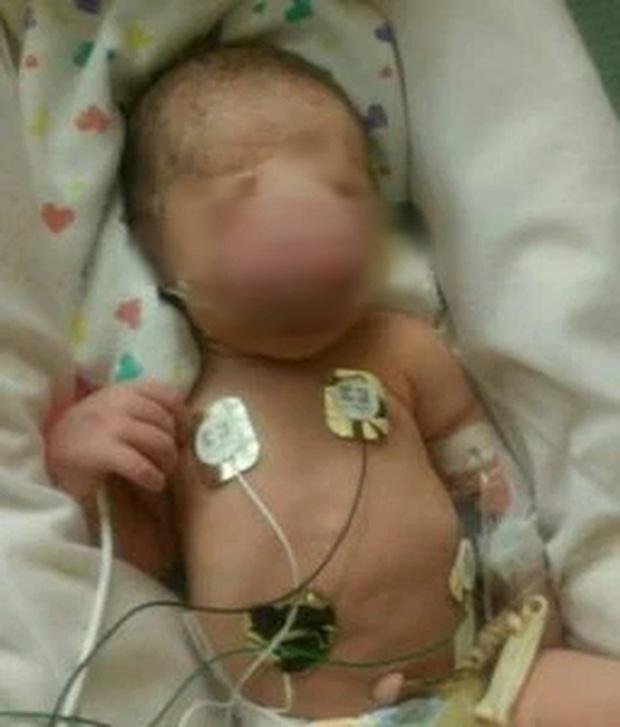 Cậu bé sinh ra bị khối u khổng lồ che lấp gây bất ngờ với diện mạo hiện tại-1