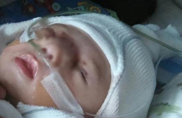 Cậu bé sinh ra bị khối u khổng lồ che lấp gây bất ngờ với diện mạo hiện tại-4