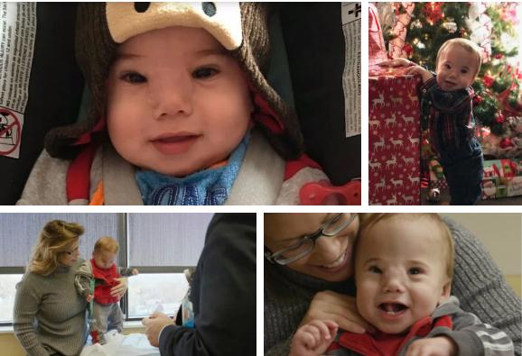 Cậu bé sinh ra bị khối u khổng lồ che lấp gây bất ngờ với diện mạo hiện tại-6