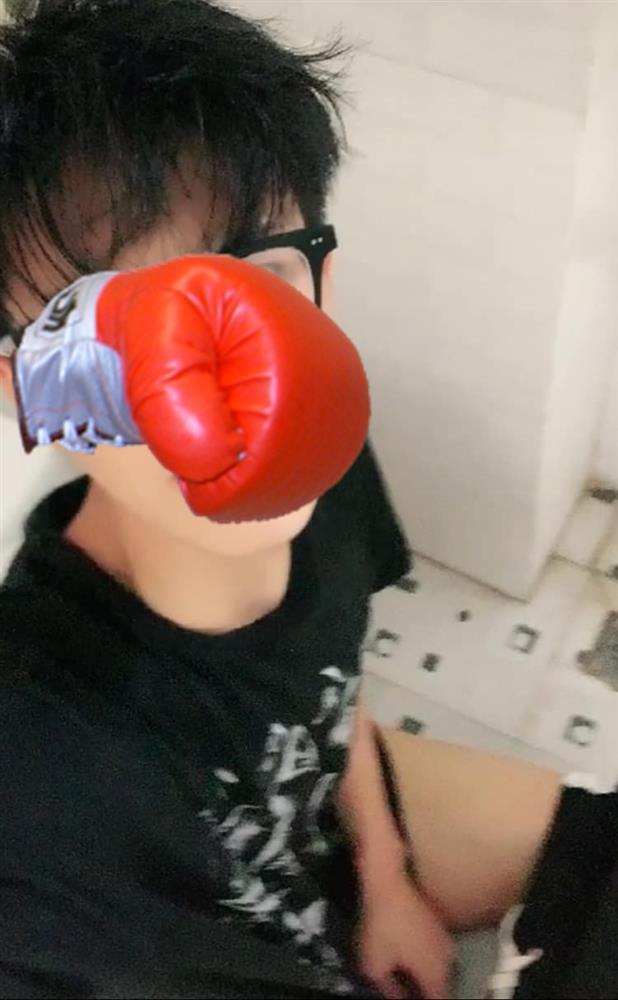 Dân mạng kinh tởm TikToker quay cảnh đi ẻ rồi khoe khắp nơi-2