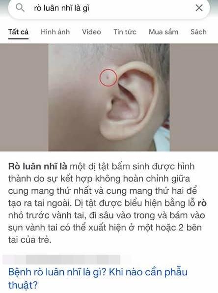 Lê Dương Bảo Lâm nhói lòng trước ngày con gái lên bàn mổ-3