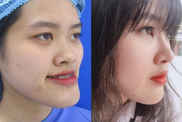 Hành trình lột xác thành hot girl của nữ sinh cảnh sát 9X-2