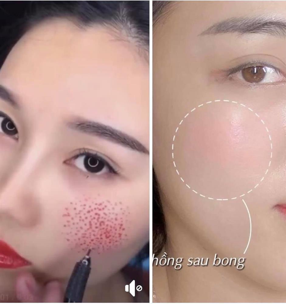 Sự thật về cấy má hồng baby, nghe xong mà muốn ngất lịm!-5