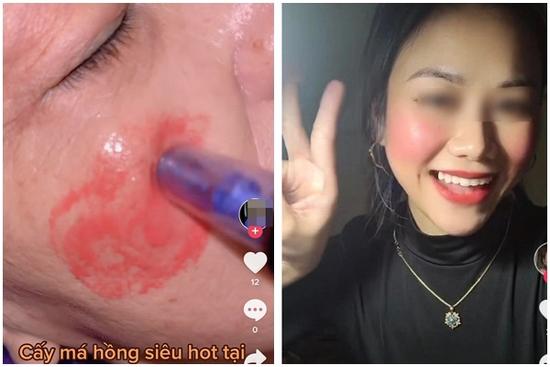 Sự thật về 'cấy má hồng baby', nghe xong mà muốn ngất lịm!