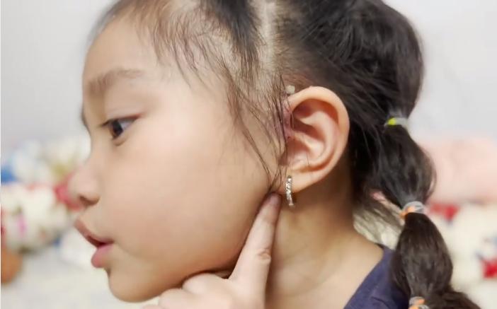 Tình trạng con gái Lê Dương Bảo Lâm sau ca mổ lần 2-5