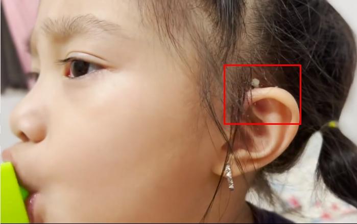 Tình trạng con gái Lê Dương Bảo Lâm sau ca mổ lần 2-6