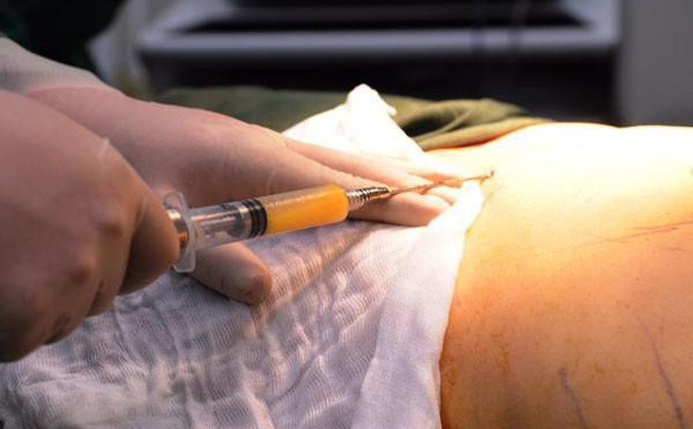 Nhóm hút mỡ gây nạn nhân tử vong: Không bằng cấp, phẫu thuật chui-1