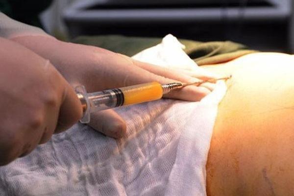 Đột phá: Lần đầu tiên ghép thành công tim lợn cho người-4