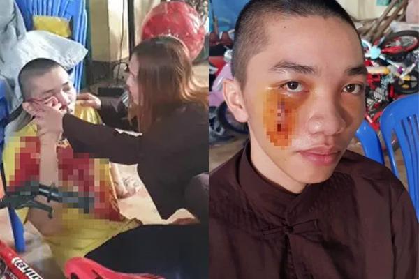 HOT: Công an đến làm việc với nhóm người Tịnh Thất Bồng Lai-3