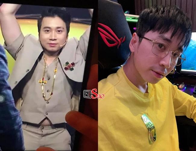 Karik gầy sọp người, mặt bé tí tẹo ai nấy hoang mang-4