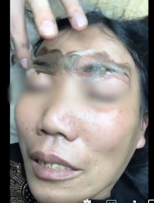 Màn xăm lông mày thiên nga hóa vịt của gái rượu dành cho mẹ yêu-5