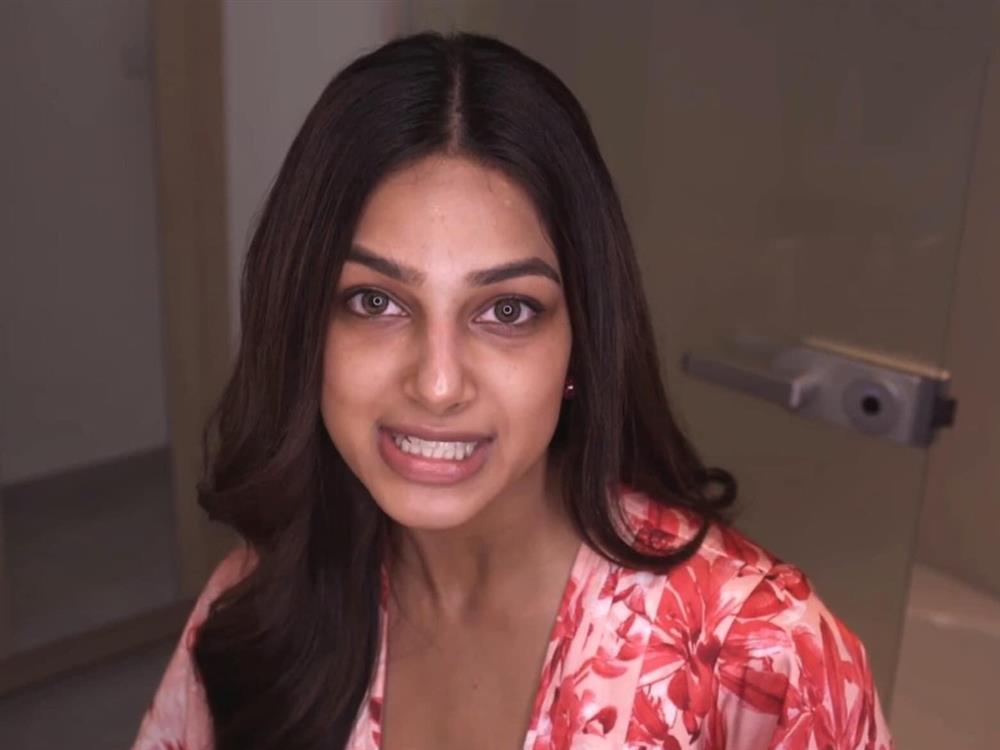 Tân Miss Universe 2021 lộ 1 khuyết điểm kém hoàn mỹ, thực chất là gì?-2