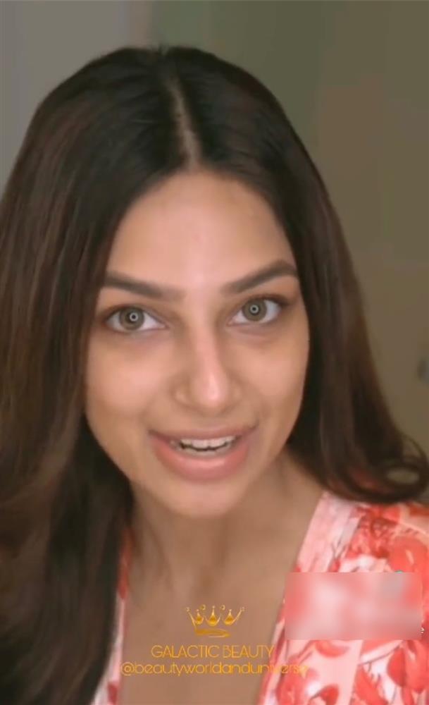 Tân Miss Universe 2021 lộ 1 khuyết điểm kém hoàn mỹ, thực chất là gì?-3