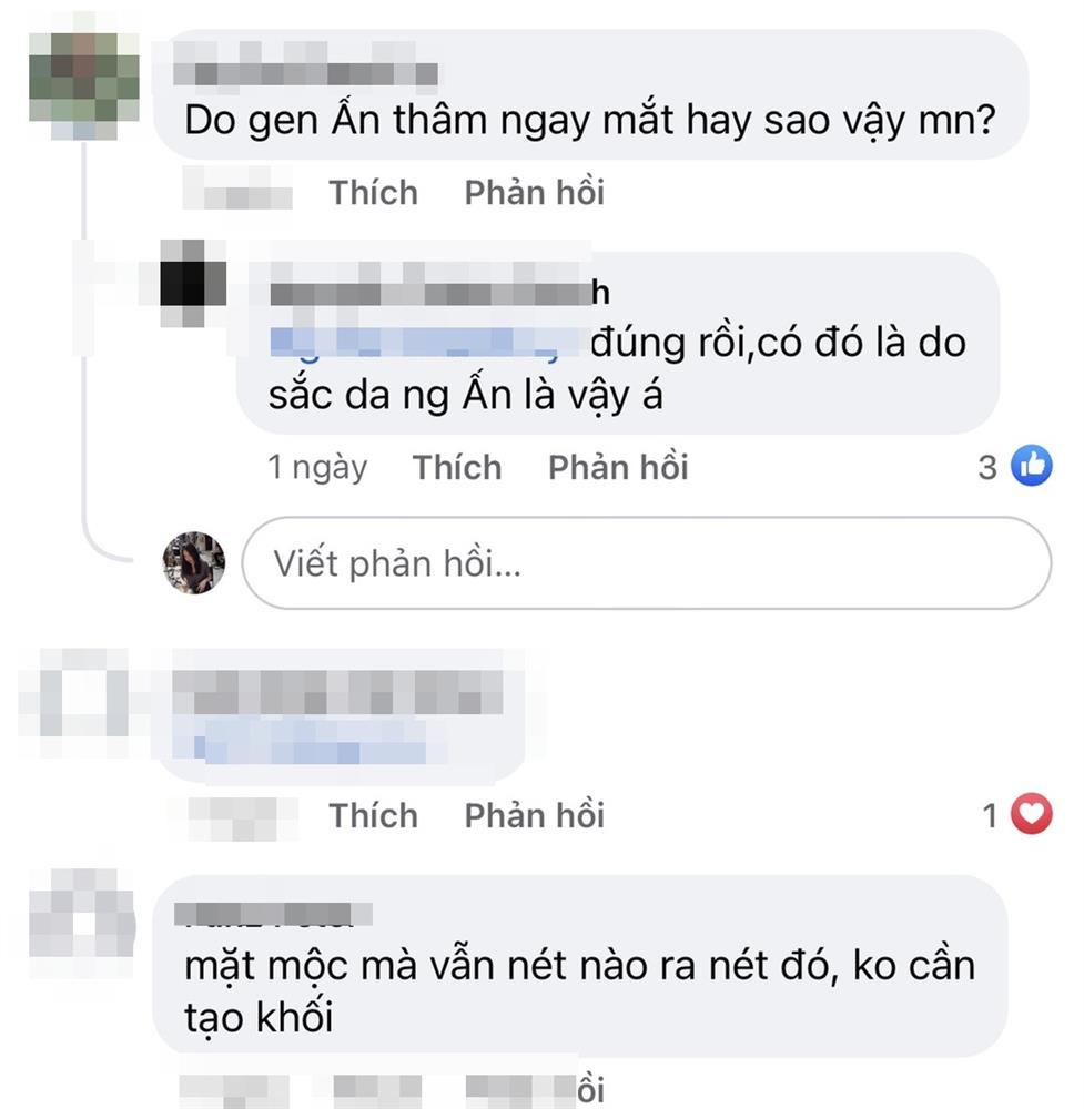 Tân Miss Universe 2021 lộ 1 khuyết điểm kém hoàn mỹ, thực chất là gì?-4