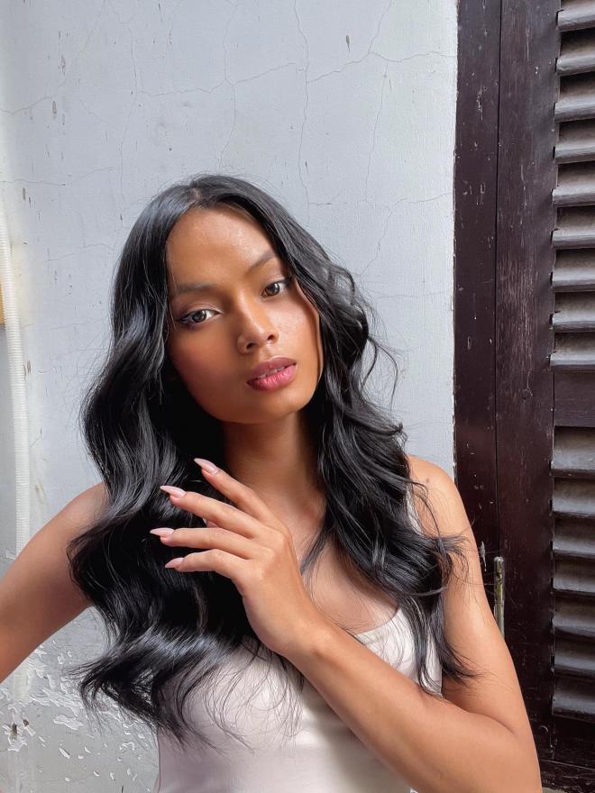 Châu Kim Sang tiết lộ tình hình sức khỏe sau ca mổ não-2