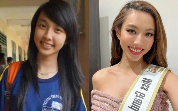 Thời đi học, Thùy Tiên có hàm răng mọc khấp khểnh, không đều. Nhờ việc niềng răng và cắt nướu, Thùy Tiên có nụ cười tươi sáng, rạng ngời hơn, tránh được tình trạng hở lại ngay cả khi cười lớn. Hoa hậu Hòa bình Quốc tế 2021 cho biết ngoài hai phương pháp này, răng của cô vẫn là răng thật.