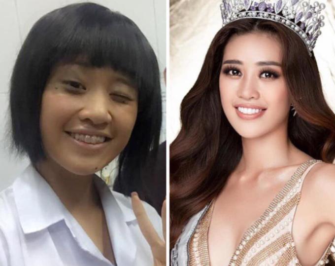 Nhìn hình ảnh của Khánh Vân thuở cắp sách đến trường, khán giả khen hoa hậu dậy thì thành công. Người đẹp cũng nhờ đến phương pháp niềng răng để có dung mạo rạng ngời như hiện tại.