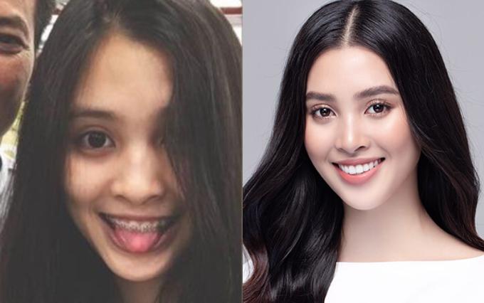 Hoa hậu Tiểu Vy từng niềng răng suốt thời cấp 3, nhờ vậy khi thi Hoa hậu Việt Nam 2018, cô đã có nụ cười trắng sáng hoàn hảo. Khuôn miệng cân đối cũng là một trong những điểm giúp Tiểu Vy được khen có gương mặt "tỷ lệ vàng".