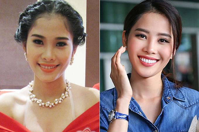 Thời điểm thi Hoa hậu Hoàn vũ Việt Nam 2015, Nam Em bắt đầu cải thiện nhan sắc. Hàm răng mới giúp gương mặt của Nam Em thon gọn hơn, diện mạo vì thế cũng trẻ trung, sang chảnh hơn hẳn.