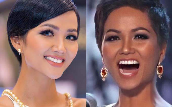 Khoảng 6 tháng trước khi tham dự Miss Universe 2018, H'Hen Niê niềng răng để khắc phục nhược điểm. Đến đấu trường sắc đẹp quốc tế, người đẹp rất tự tin với khuôn miệng cười hoàn hảo cùng hàm răng đều tăm tắp.