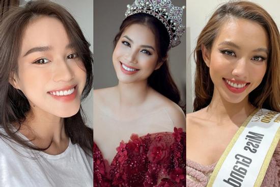 10 hoa hậu, á hậu thăng hạng nhan sắc nhờ sửa răng